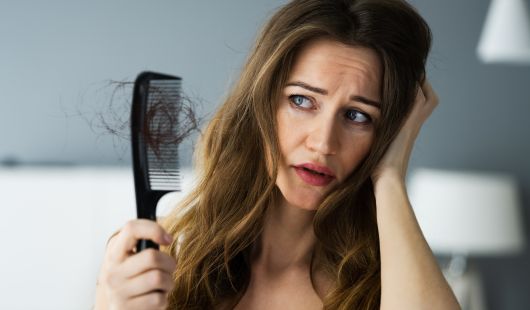 Alopecie de Traction