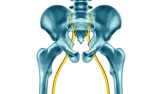 Blog posts Le syndrome du piriforme : causes, symptômes et traitements