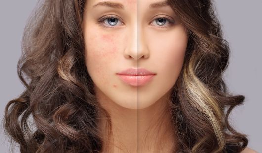 Oreiller pour peau sensible 