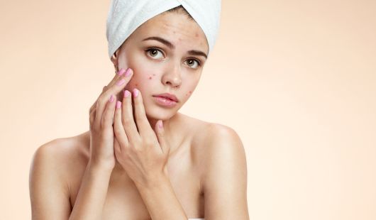 Peau Atopique et Eczéma Quelle Taie d’Oreiller Choisir